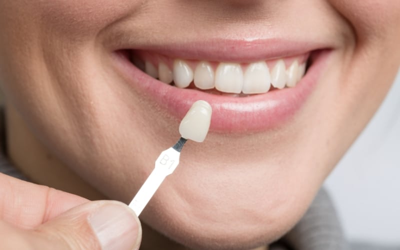 Cosmetic Dentistry Treatment near College Road Nashik | Care 32