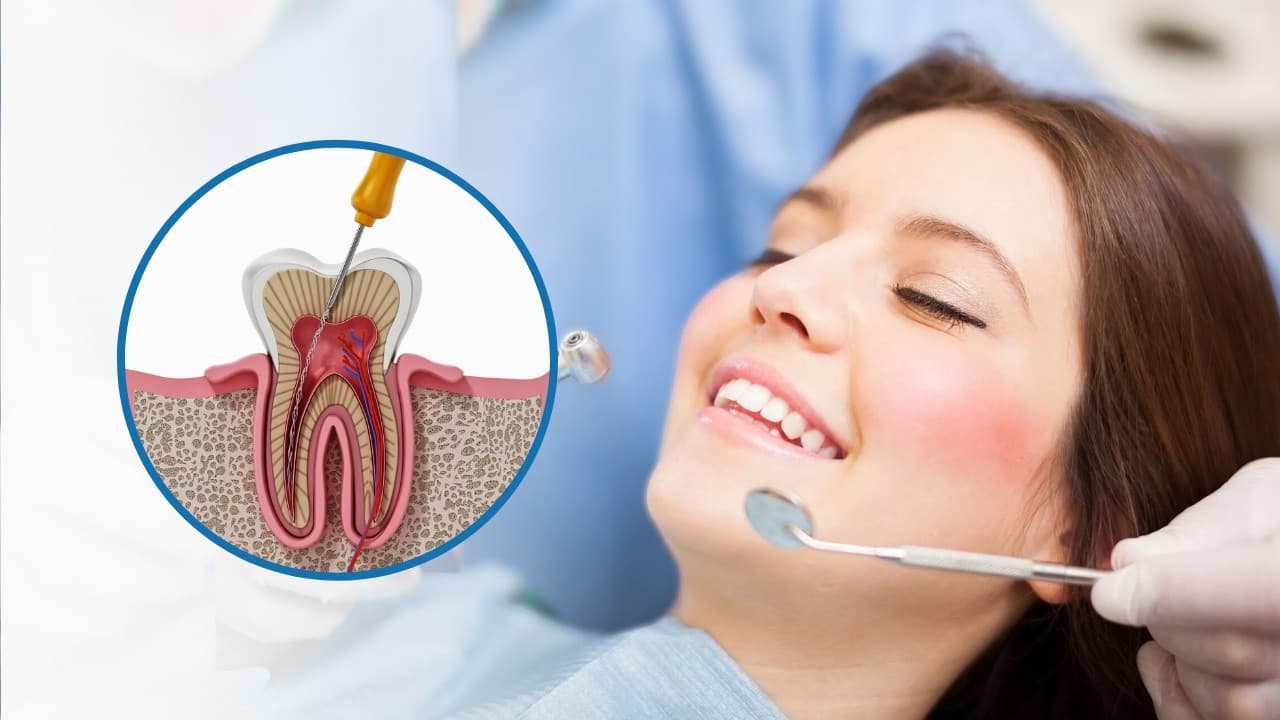Painless Root Canal Treatment in Panchavati Nashik | Care 32 Clinic